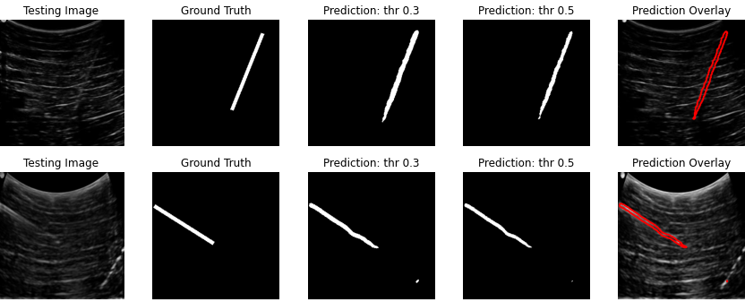 Sample predictions